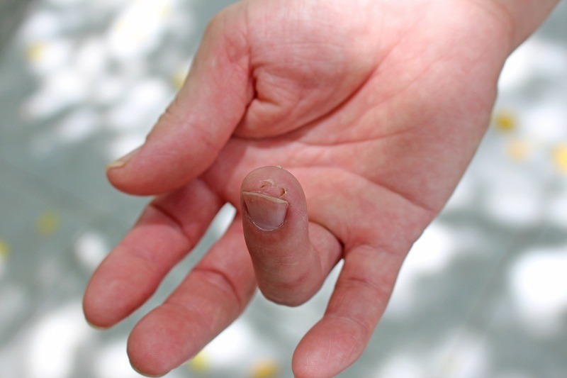 照顧歐亞水獺大金小金時手指被咬傷，陳朝輝笑說面對的是野生動物，這點小傷很正常。　李娉婷/攝